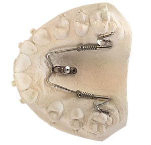 Miniimplantate